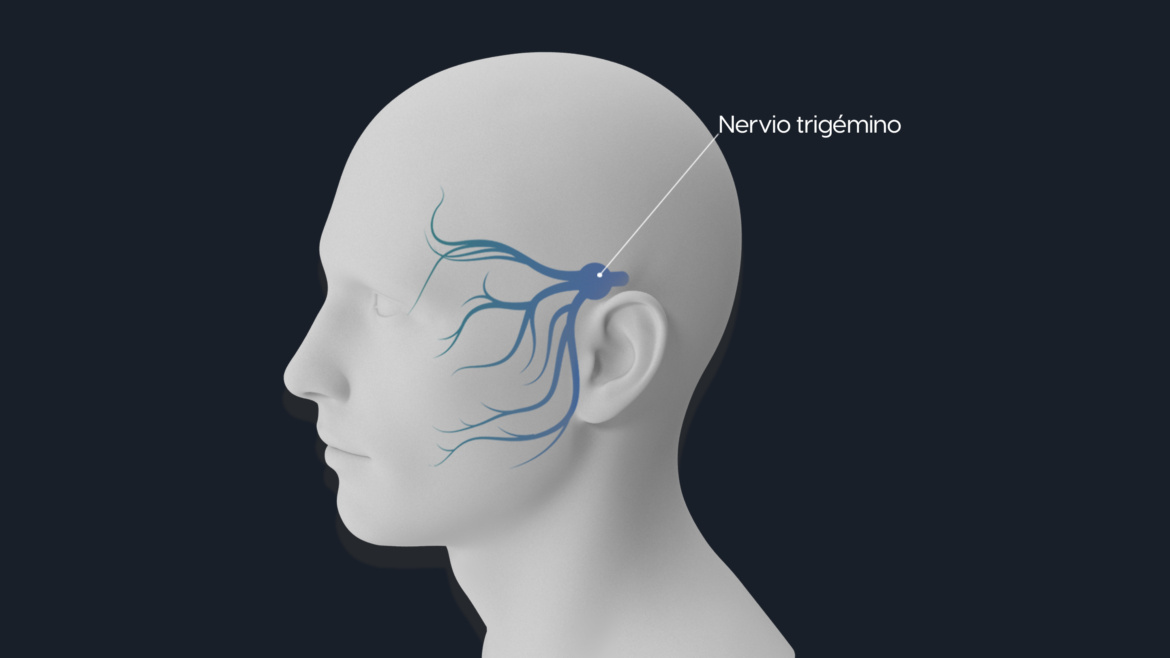 Neuralgia del Trigémino